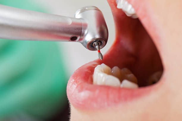 Best Urgent Tooth Repair  in Cienegas Terrace, TX
